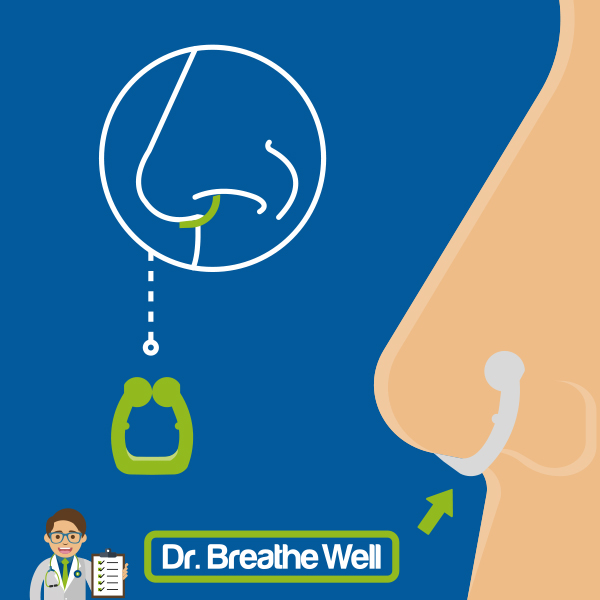 Dilatador nasal antironquidos: Todas las ventajas de contar con el